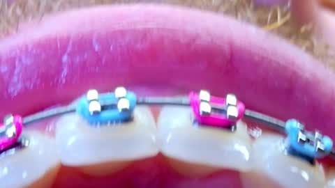 Snapshot of los_juanes chatting on 02.15.26 JUAN JUAN online show from 02.15.26