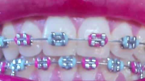 Snapshot of los_juanes chatting on 02.28.26 JUAN JUAN online show from 02.28.26