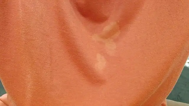 Cholatin online show from 10.07.25